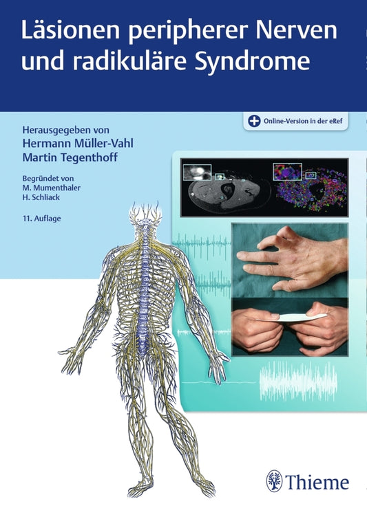 Läsionen peripherer Nerven und radikuläre Syndrome (Hermann Müller-Vahl)