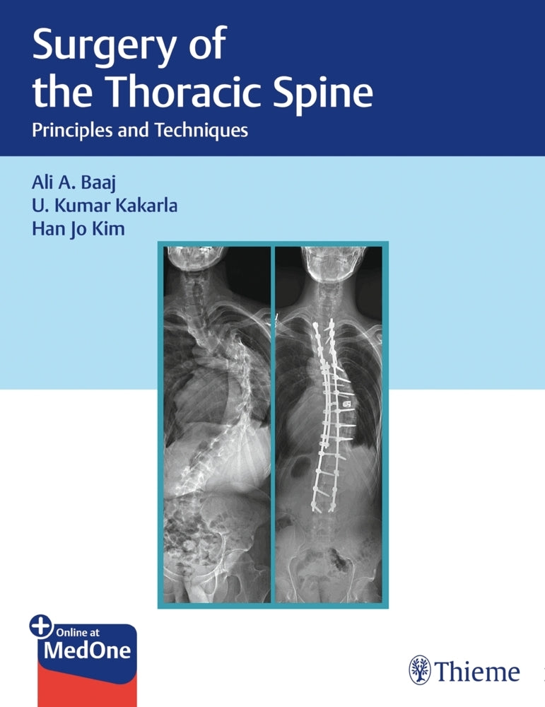 Surgery of the Thoracic Spine (Ali A. Baaj)