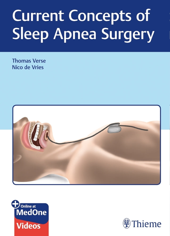 Current Concepts of Sleep Apnea Surgery (Thomas Verse)