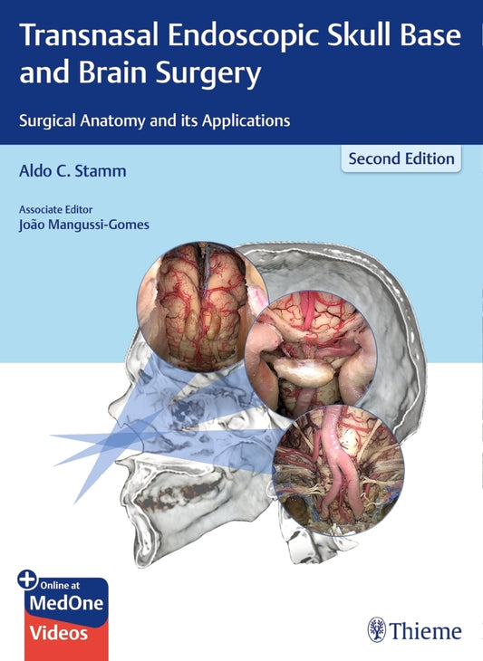 Transnasal Endoscopic Skull Base and Brain Surgery (Aldo C. Stamm)