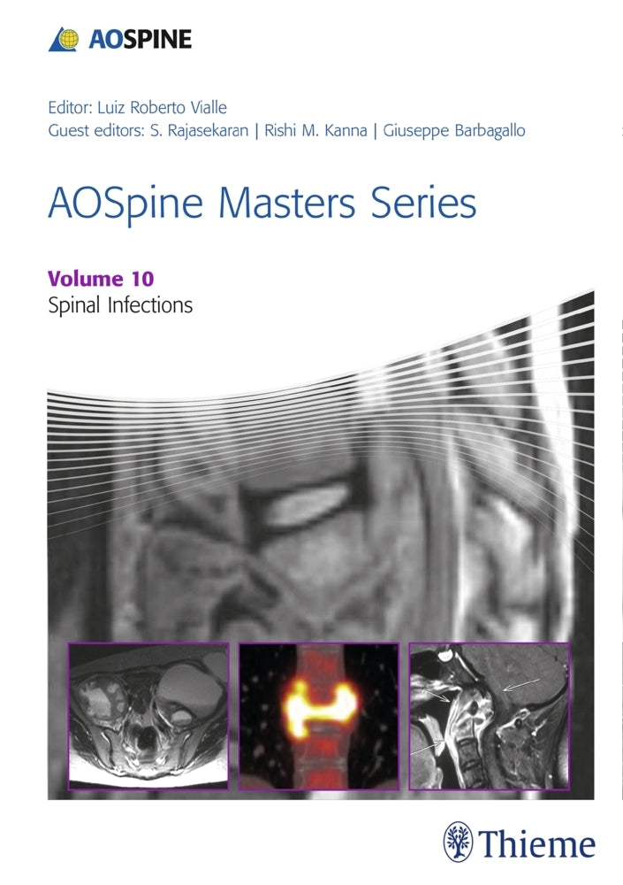 AOSpine Masters Series, Volume 10: Spinal Infections (Rishi Kanna)