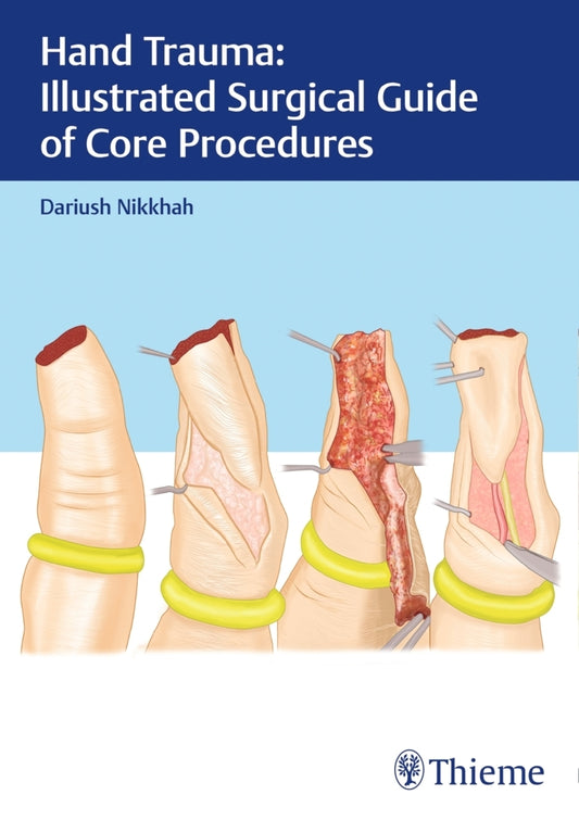 Hand Trauma: Illustrated Surgical Guide of Core Procedures (Dariush Nikkhah)