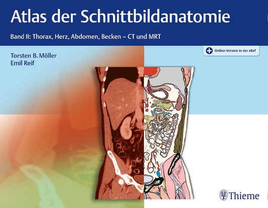 Atlas der Schnittbildanatomie.Bd.2 (Torsten B. Möller)