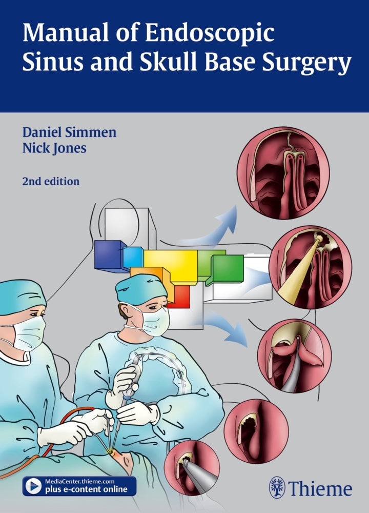 Manual of Endoscopic Sinus Surgery (Daniel Simmen)