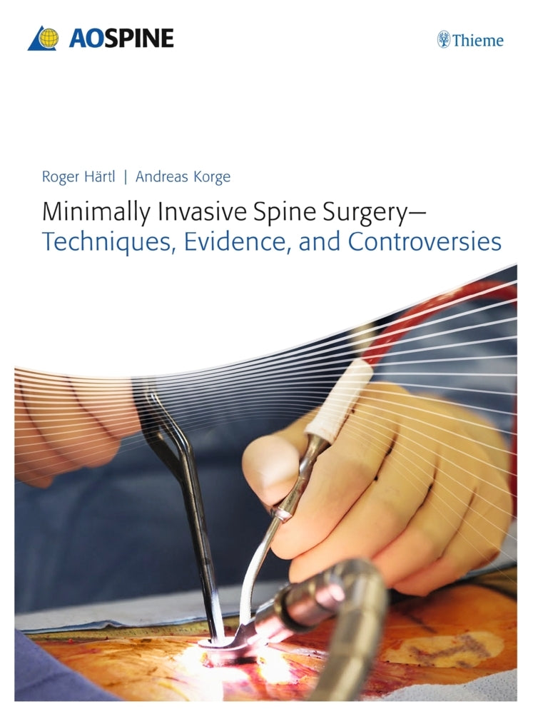 Minimally Invasive Spine Surgery - Techniques, Evidence, and Controversies (Roger Haertl)
