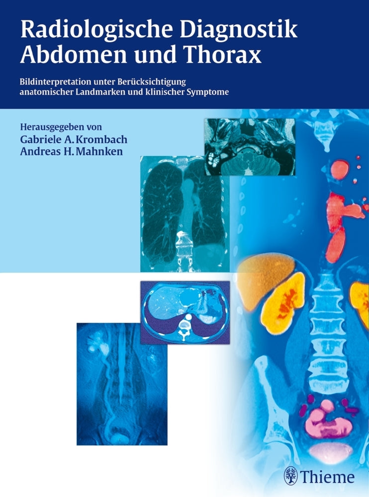 Radiologische Diagnostik Abdomen und Thorax (Gabriele A. Krombach)