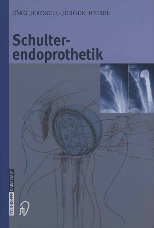 Schulterendoprothetik (Jörg Jerosch)