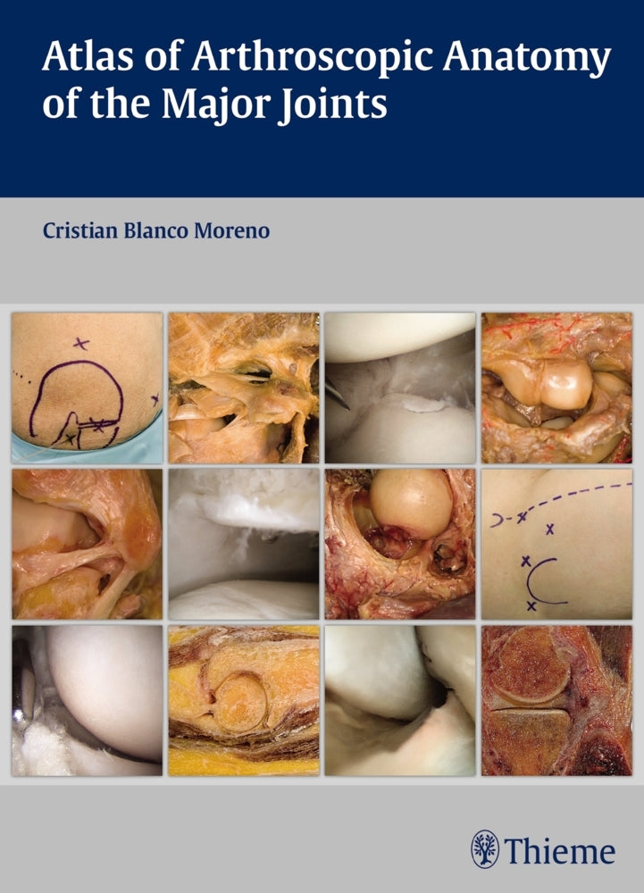 Atlas of Arthroscopic Anatomy of the Major Joints (Cristian Blanco Moreno)