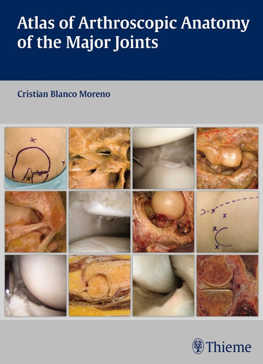 Atlas of Arthroscopic Anatomy of the Major Joints (Cristian Blanco Moreno)