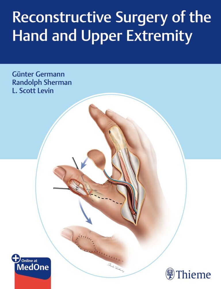 Reconstructive Surgery of the Hand and Upper Extremity (Günter Germann)