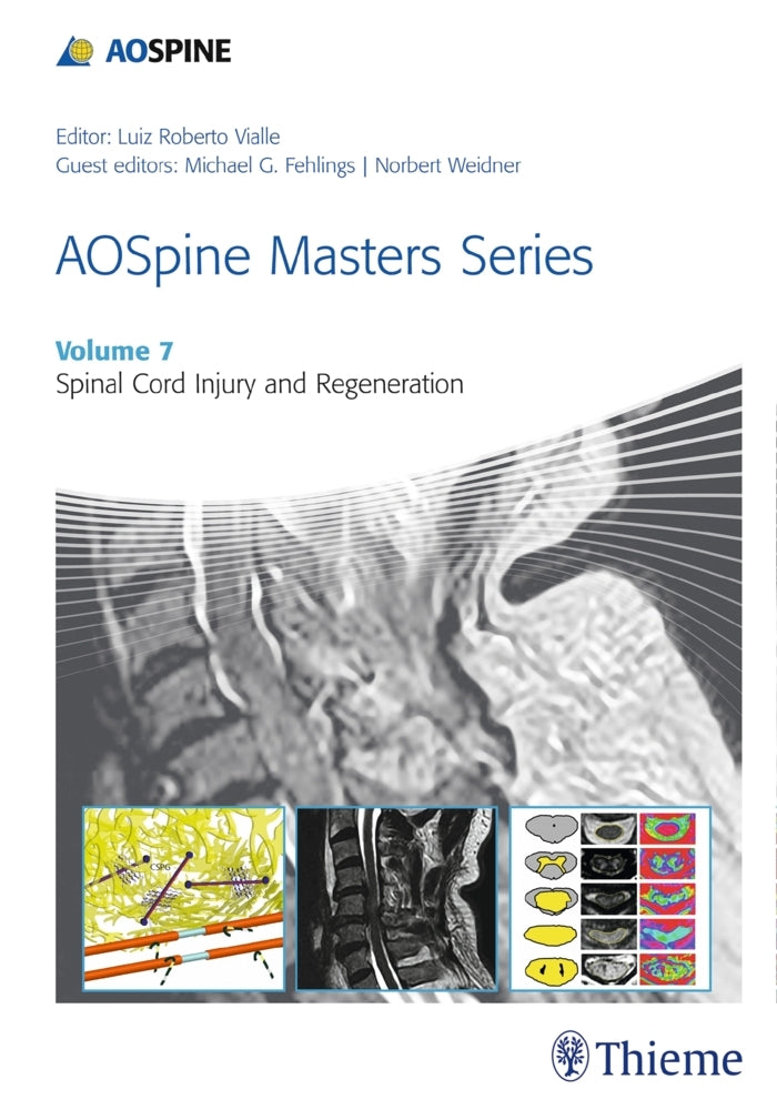 AOSpine Masters Series - Spinal Cord Injury and Regeneration (Luiz R. Vialle)