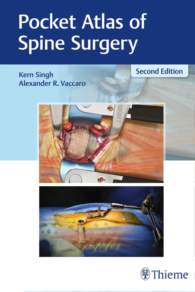 Pocket Atlas of Spine Surgery (Kern Singh)