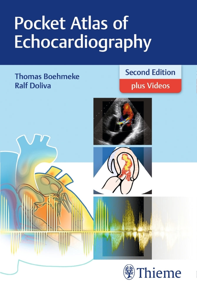 Pocket Atlas of Echocardiography (Thomas Böhmeke)