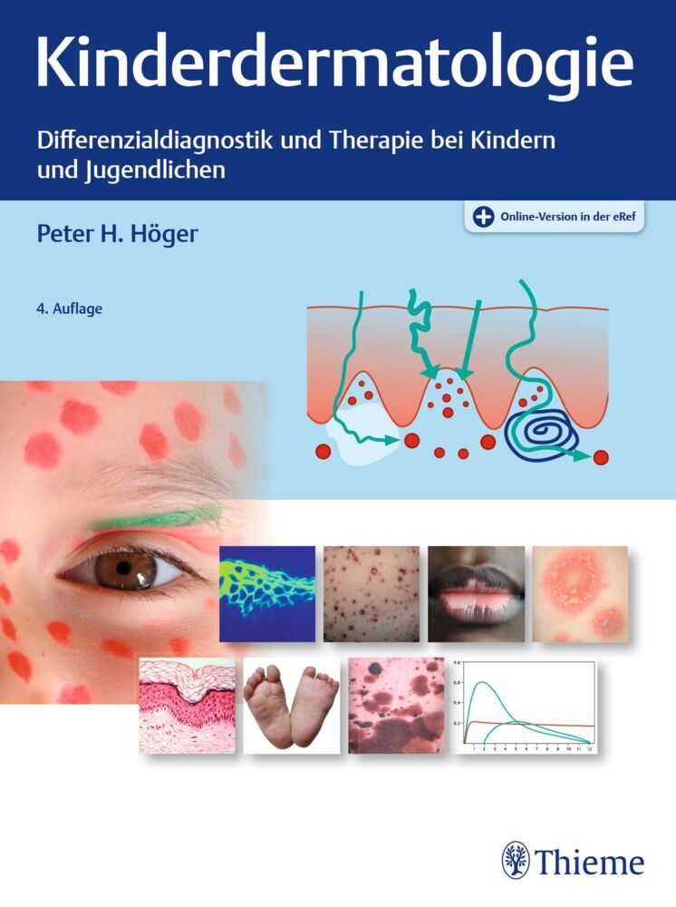 Kinderdermatologie (Peter H. Höger)