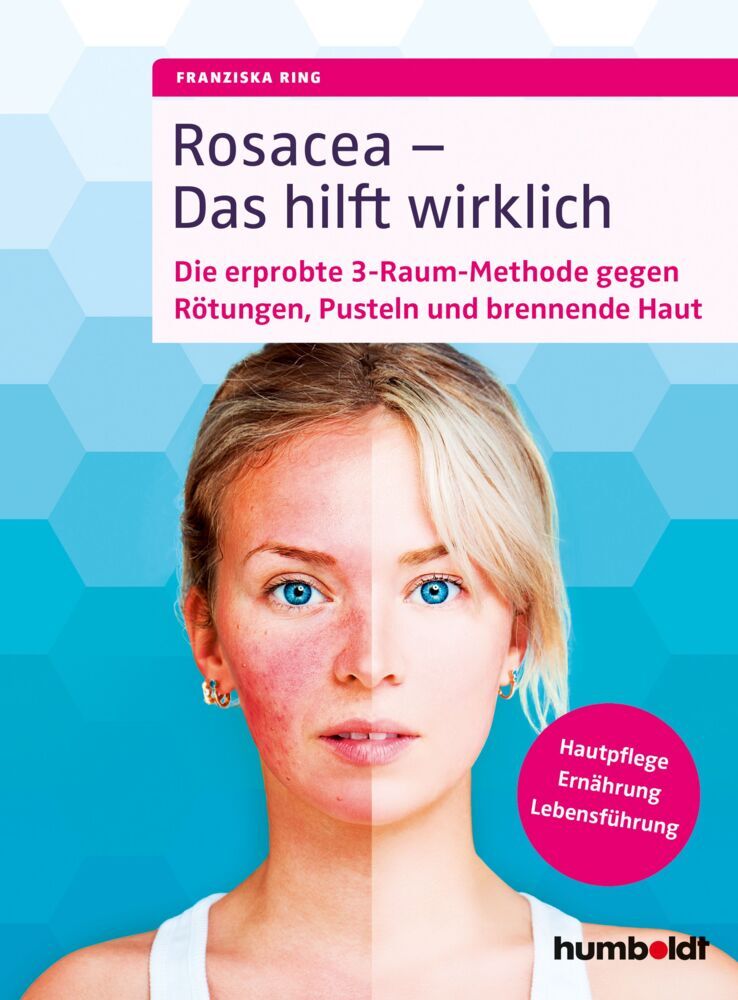 Rosacea - Das hilft wirklich (Franziska Ring)