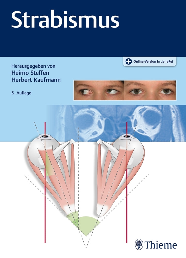 Strabismus (Heimo Steffen)