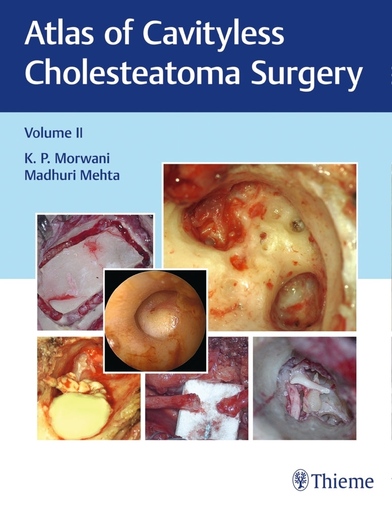 Atlas of Cavityless Cholesteatoma Surgery, Vol 2.Vol.2 (K Morwani)