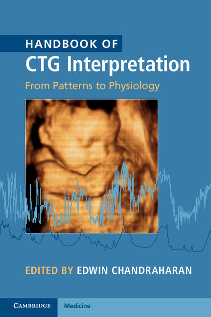 Handbook of CTG Interpretation (Edwin Chandraharan)