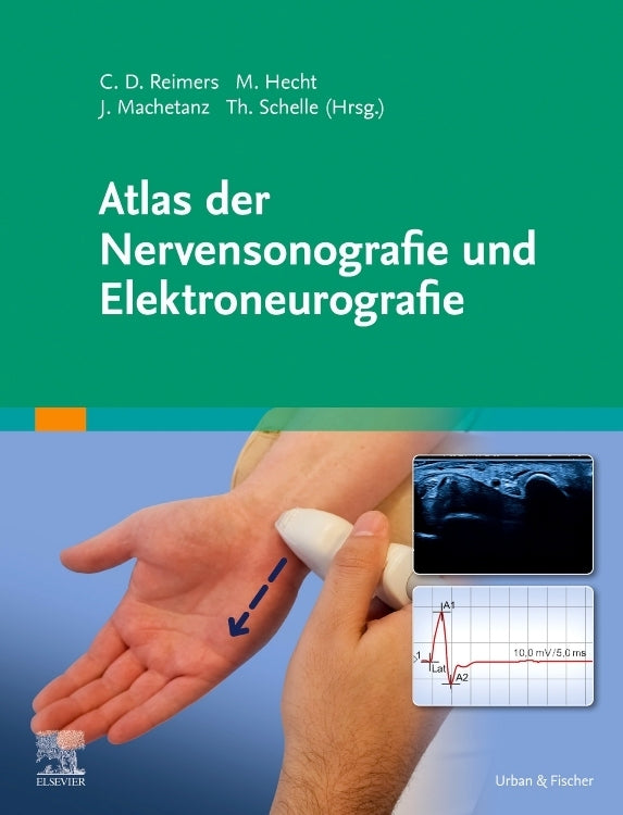Atlas der Nervensonografie und Elektroneurografie (Carl Detlev Reimers)