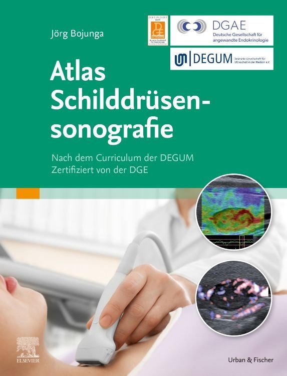 Atlas Schilddrüsensonografie (Jörg Bojunga)