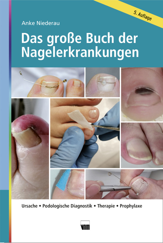 Das große Buch der Nagelerkrankungen (Anke Niederau)