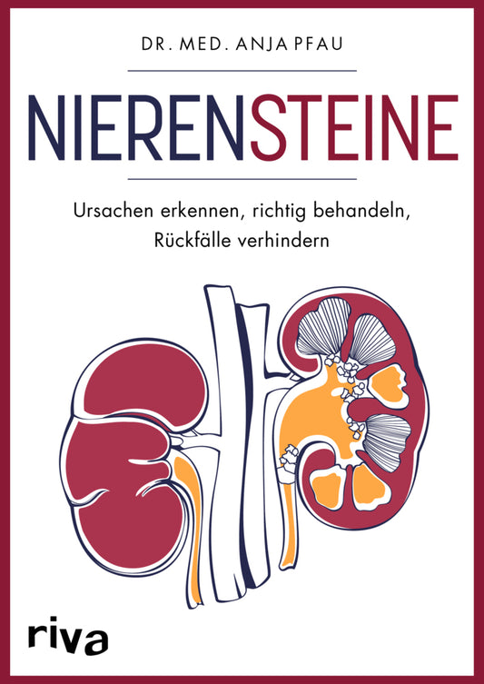 Nierensteine - Ursachen erkennen, richtig behandeln, Rückfälle verhindern (Anja Pfau)