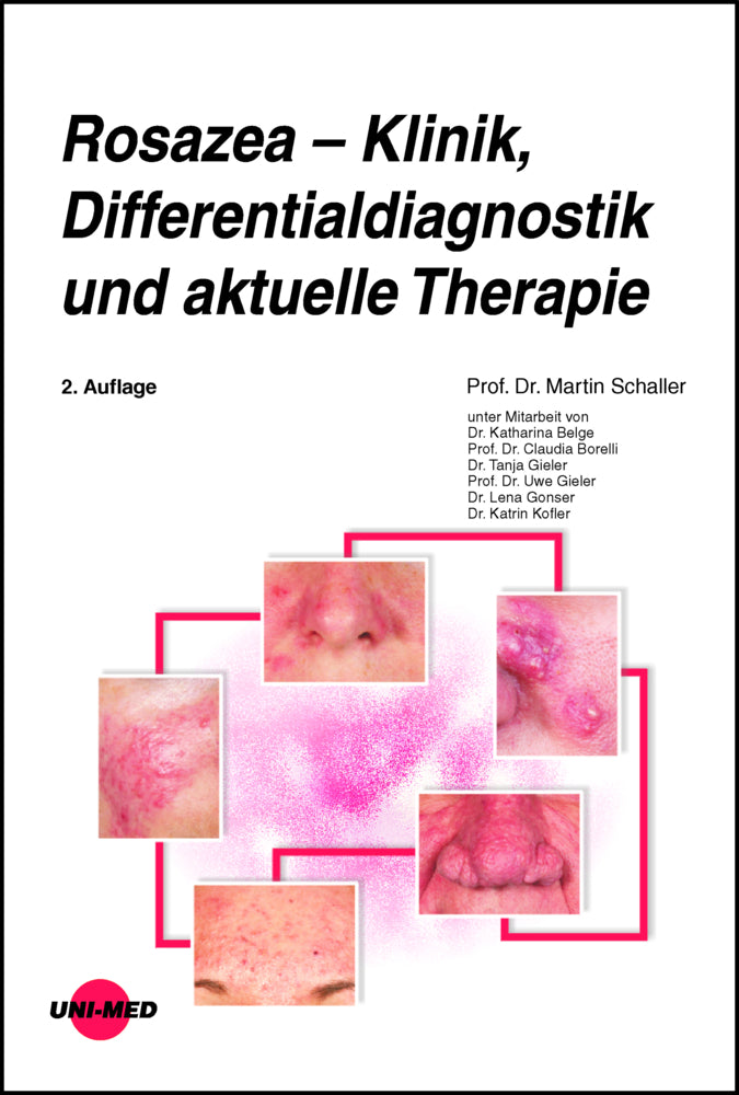 Rosazea - Klinik, Differentialdiagnostik und aktuelle Therapie (Martin Schaller)