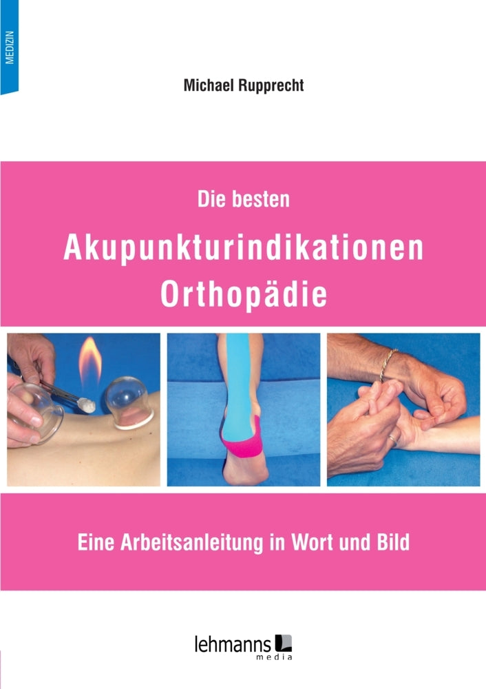 Die besten Akupunkturindikationen Orthopädie (Michael Rupprecht)