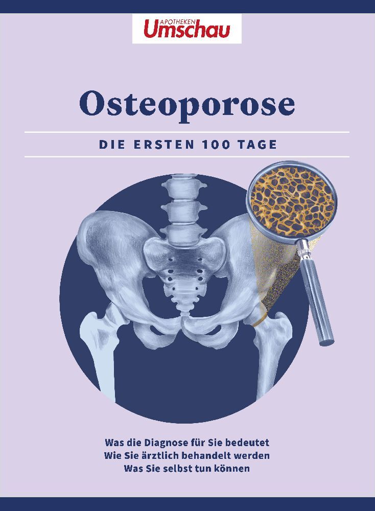 Apotheken Umschau: Osteoporose (Wort & Bild Verlag)