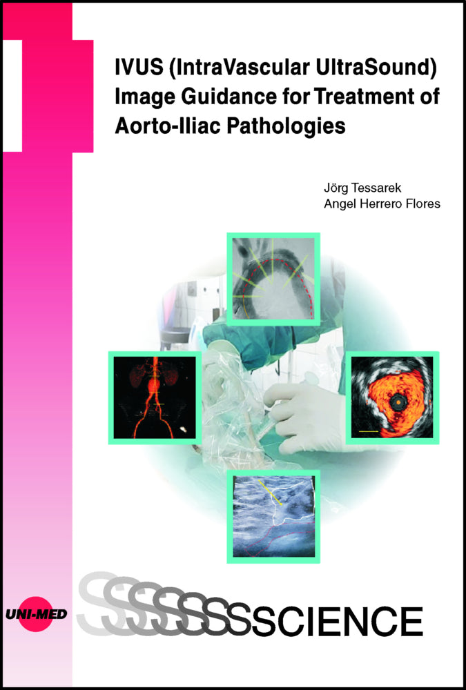 IVUS (IntraVascular UltraSound) Image Guidance for Treatment of Aorto-Iliac Pathologies (Jörg Teßarek)