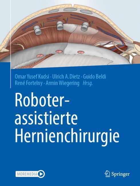 Roboterassistierte Hernienchirurgie (Omar Yusef Kudsi)
