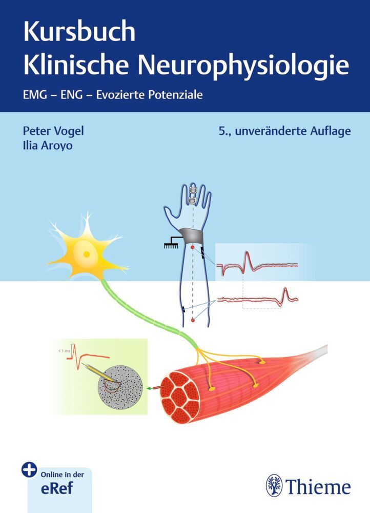 Kursbuch Klinische Neurophysiologie (Peter Vogel)