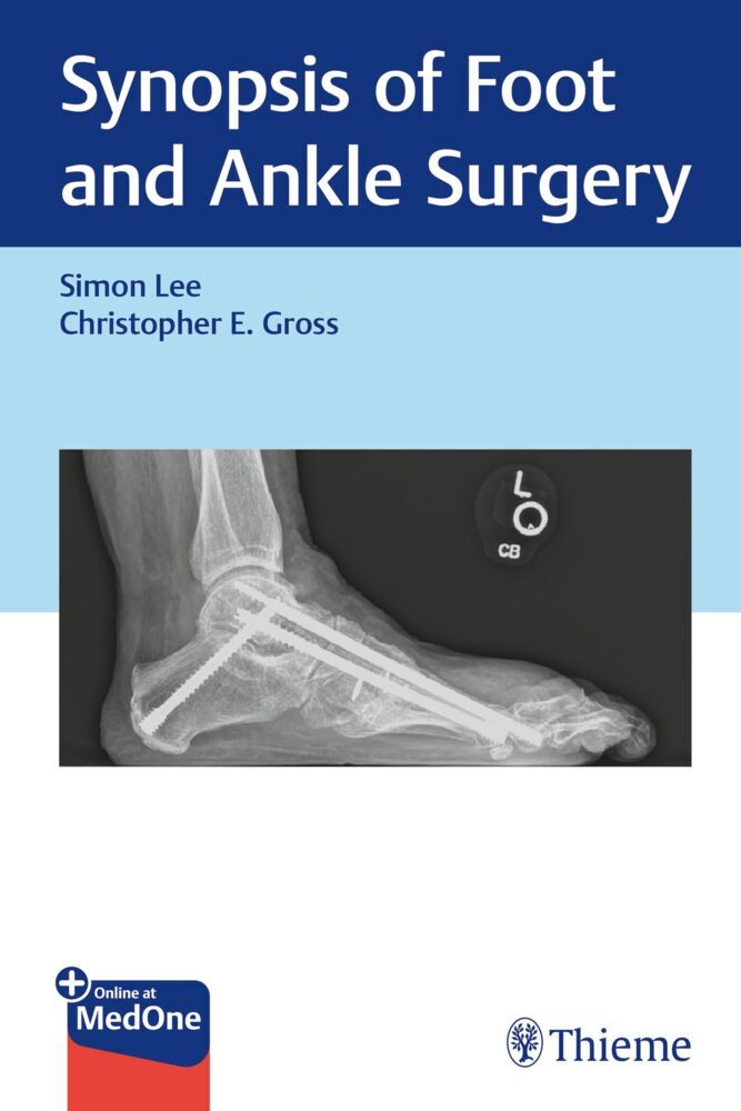 Synopsis of Foot and Ankle Surgery (Simon Lee)