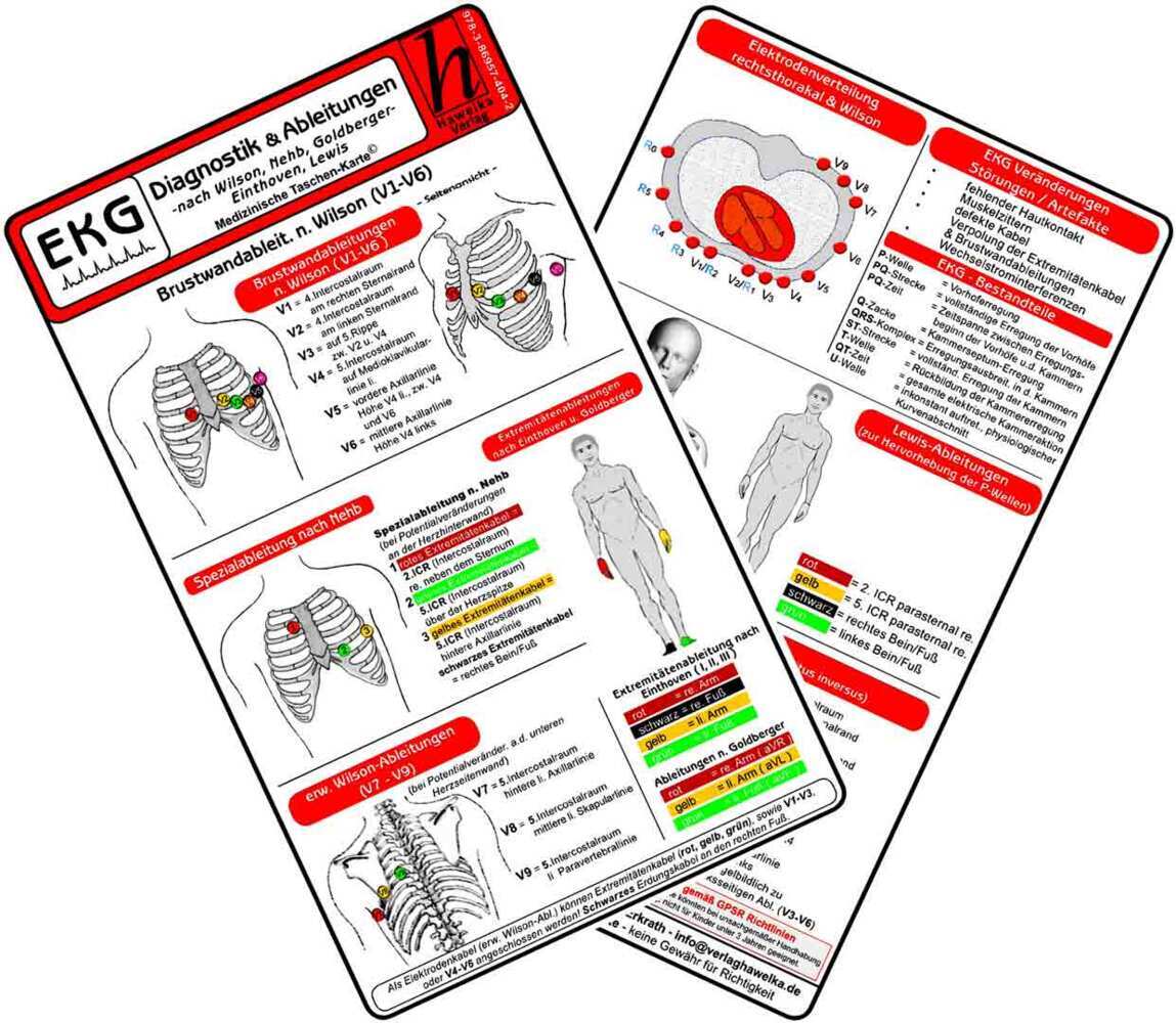EKG Diagnostik & Ableitungen - Medizinische Taschen-Karte (Verlag Hawelka Verlag)