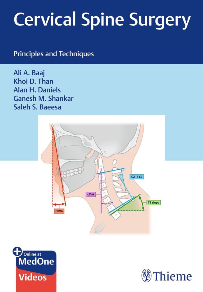 Cervical Spine Surgery (Ali A. Baaj)